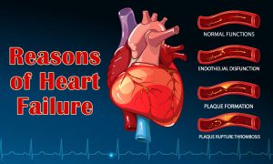 Reasons of heart attack