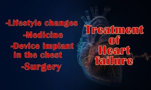 Treatment of heart failure